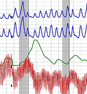 polygraph test in Lawndale